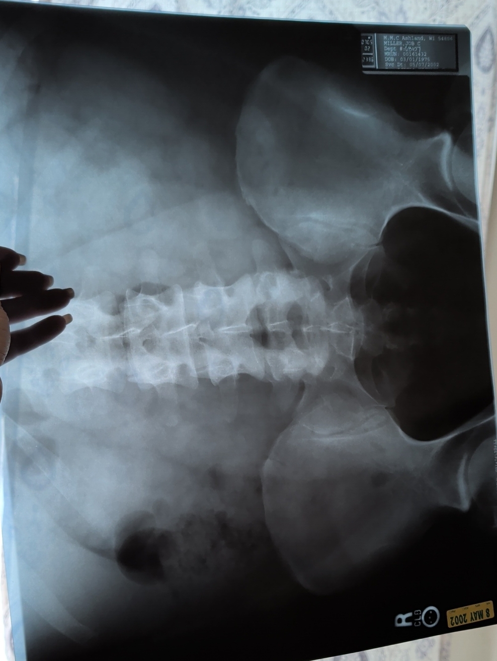 X-ray And Medical Ultrasound Film Art Movie Prop Curiosity Oddities Macabre
